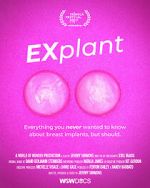 Watch Explant Putlocker