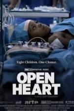Watch Open Heart Putlocker