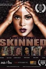 Watch Skinned Putlocker